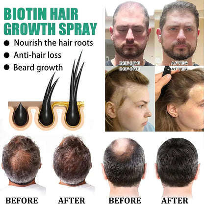 Biotin Hair Growth Serum Spray Help Grow Healthy, Strong Hair, ,Thinning Hair Loss Regrowth Treatment for Men & Women Refreshing