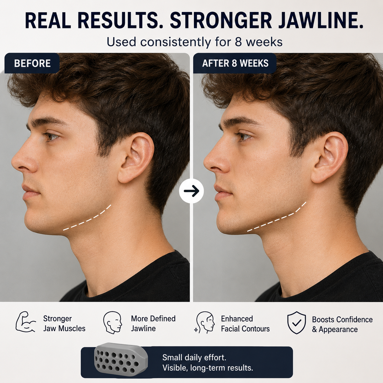 Seralina™ Facial Muscle Trainer Looksmaxxing Tool